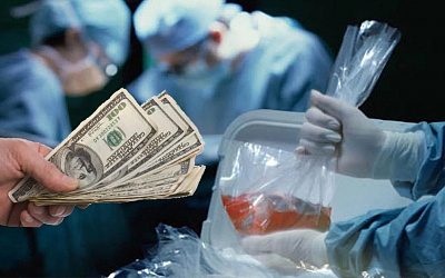 Черные трансплантологи: Киев начинает признавать правдивость «российской пропаганды»